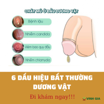 Dương vật gặp dấu hiệu bất thường này, đến gặp bác sĩ ngay!